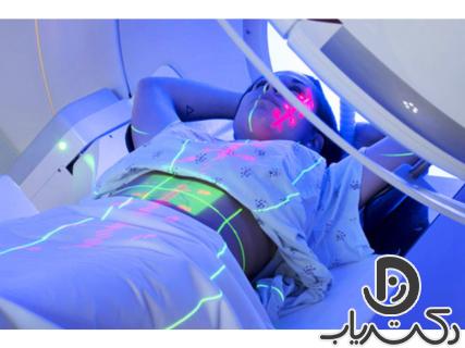 Gastric cancer radiation therapy