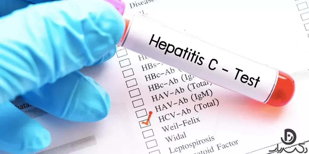 Hepatitis test10