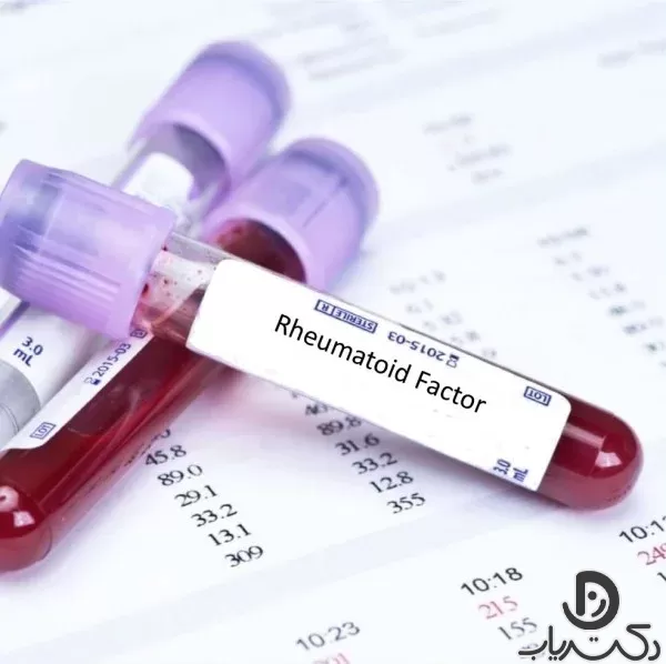 Rheumatism test RA