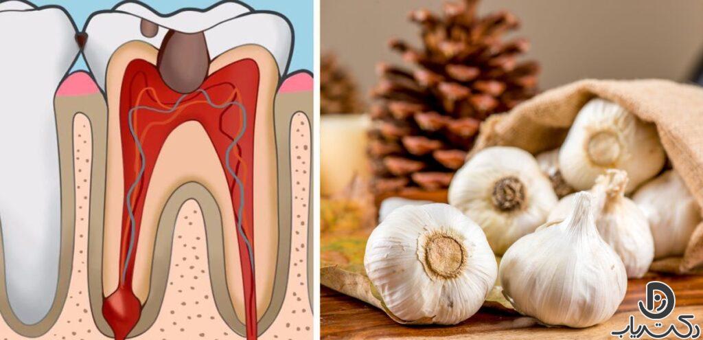 Treatment of toothache with garlic