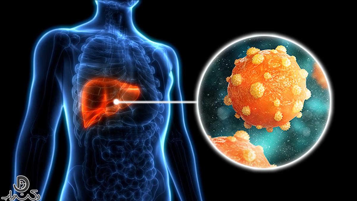 هپاتیت چیست و چگونه بر بدن تأثیر می‌گذارد؟