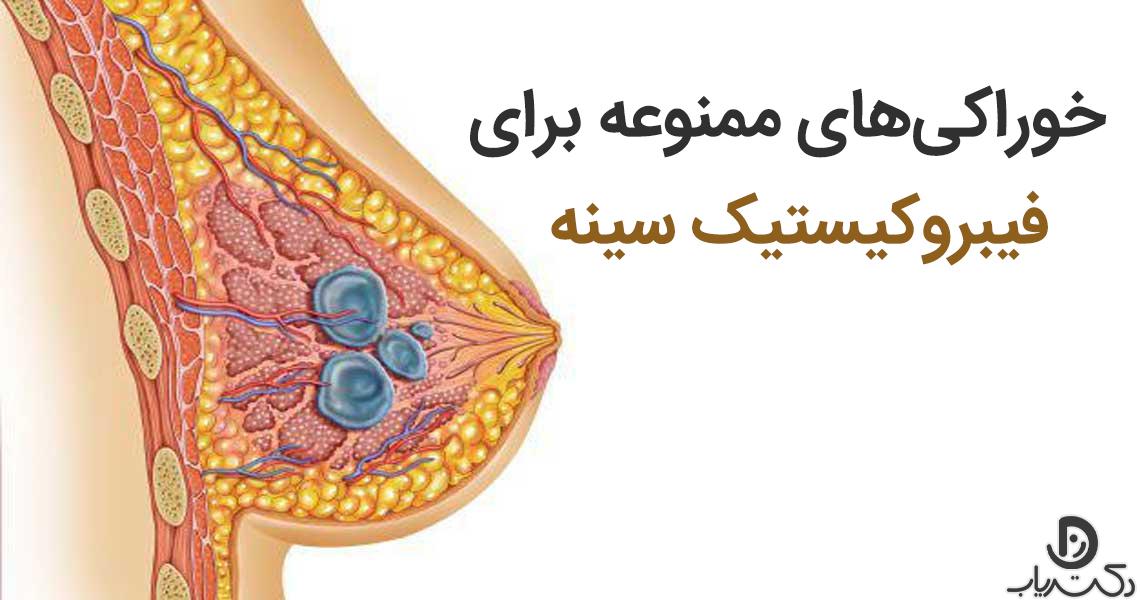 لیست خوراکی‌های ممنوع برای فیبروکیستیک سینه