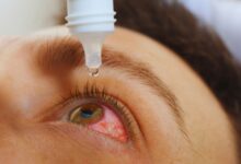 بهترین قرص و آنتی بیوتیک برای عفونت چشم