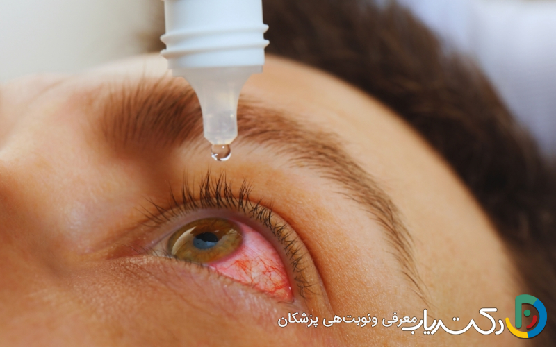 بهترین قرص و آنتی بیوتیک برای عفونت چشم