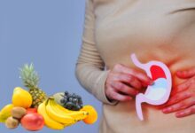 بهترین میوه برای زخم معده