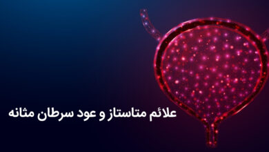 علائم متاستاز و عود سرطان مثانه