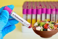 بهترین غذاها برای تالاسمی مینور