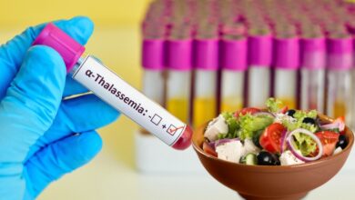 بهترین غذاها برای تالاسمی مینور