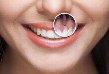 آیا ایمپلنت دندان دردناک است؟