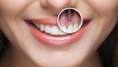 آیا ایمپلنت دندان دردناک است؟