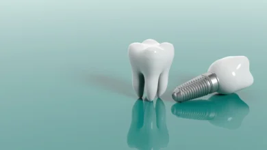 چه خطرات احتمالی در طول یا بعد از عمل ایمپلنت دندان وجود دارد؟