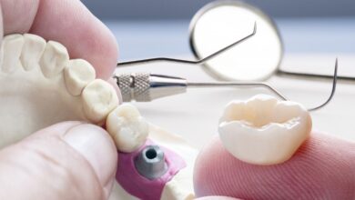 آیا روکش دندان مقاوم به شکست است؟