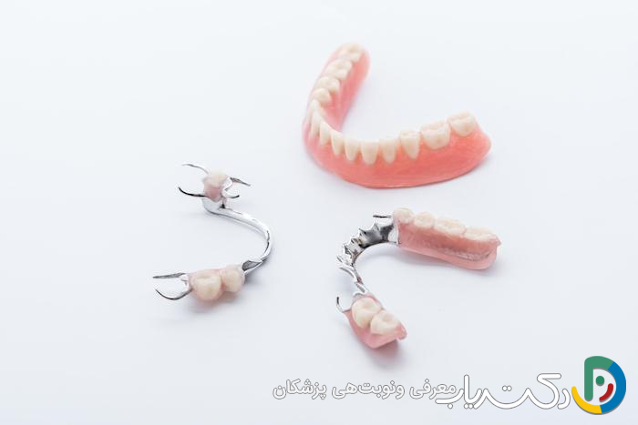 آیا دندان مصنوعی به راحتی جا به جا نمی شود؟