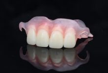 آیا دندان مصنوعی برای دندان های جلو مناسب است؟