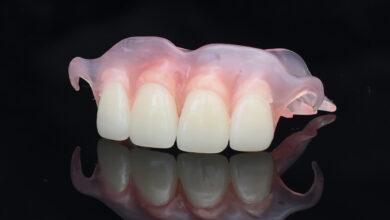 آیا دندان مصنوعی برای دندان های جلو مناسب است؟