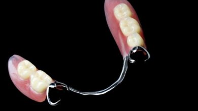 آیا دندان مصنوعی برای جایگزینی دندانهای عقب مناسب است؟