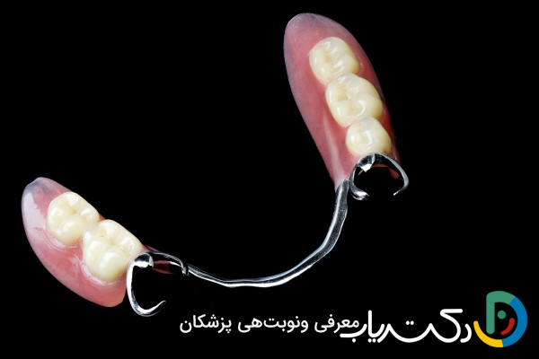 آیا دندان مصنوعی برای جایگزینی دندان‌های عقب مناسب است؟