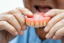 آیا دندان مصنوعی بهترین گزینه برای از دست دادن دندانهاست؟