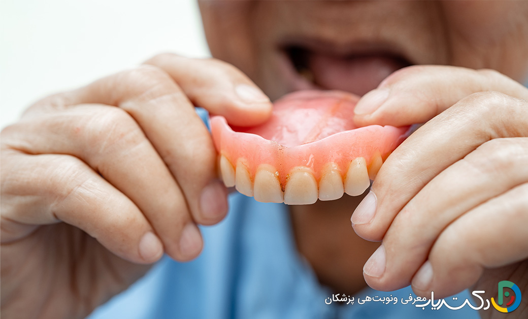 آیا دندان مصنوعی بهترین گزینه برای از دست دادن دندانهاست؟