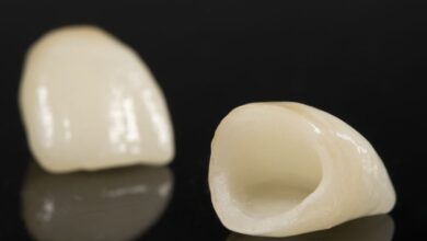 آیا روکش دندان ممکن است کنده شود؟