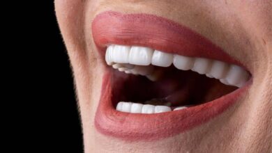 آیا روکش دندان می تواند به زیبایی لبخند کمک کند؟
