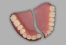 آیا دندان مصنوعی قابل تعمیر است؟