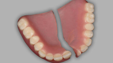 آیا دندان مصنوعی قابل تعمیر است؟