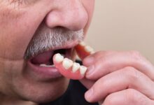 آیا دندان مصنوعی ممکن است شل شود؟
