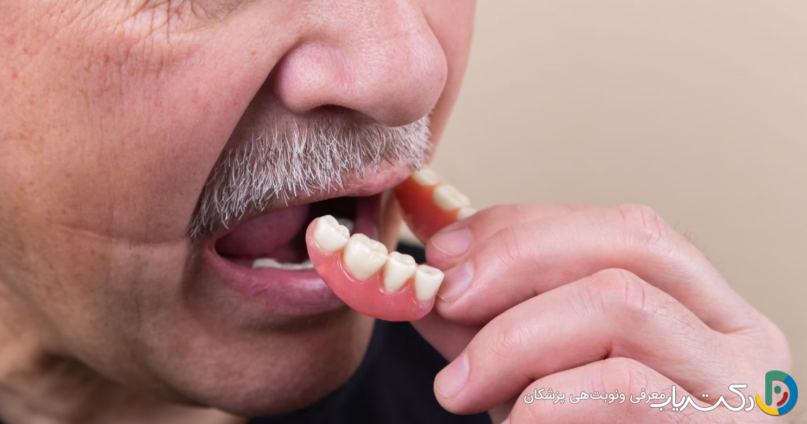 آیا دندان مصنوعی ممکن است شل شود؟