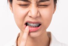 آیا ارتودنسی می تواند باعث درد دندان ها شود؟