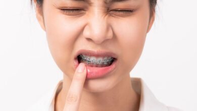 آیا ارتودنسی می تواند باعث درد دندان ها شود؟