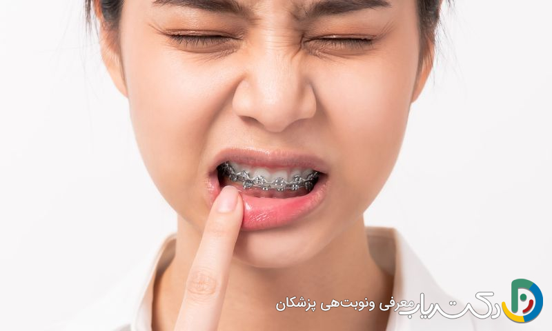 آیا ارتودنسی می تواند باعث درد دندان ها شود؟