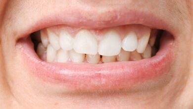 آیا ارتودنسی می تواند باعث رفع مشکلات فکی شود؟