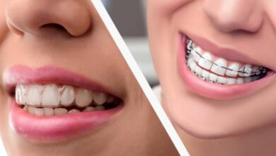 آیا ارتودنسی می تواند مشکلات دندانی را برای همیشه حل کند؟