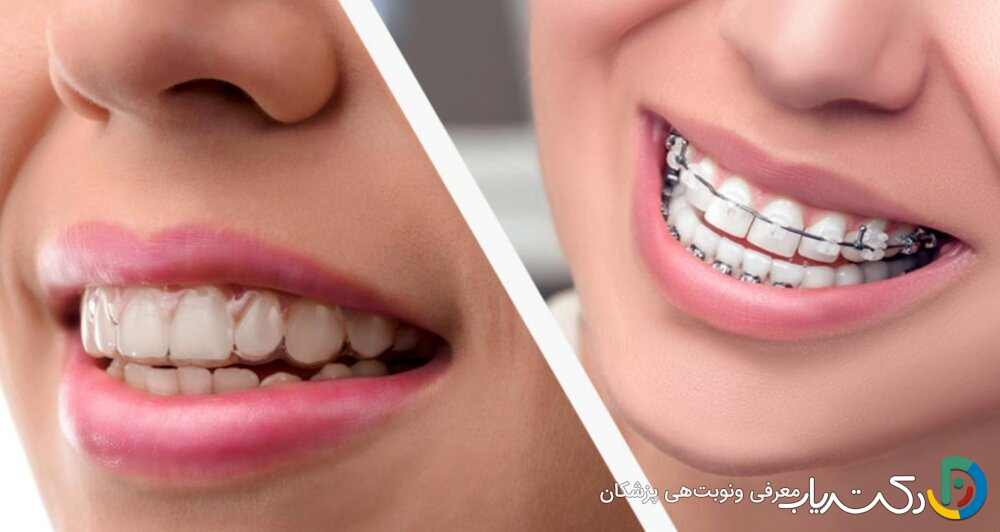 آیا ارتودنسی می تواند مشکلات دندانی را برای همیشه حل کند؟