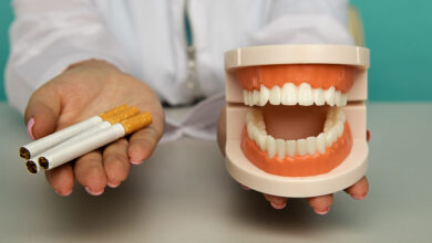 آیا افراد سیگاری می توانند ایمپلنت کنند؟