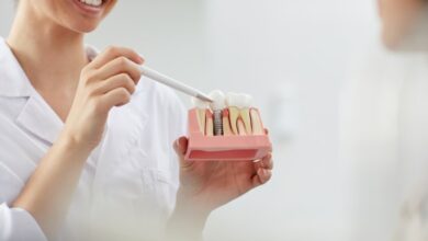 بهترین مقاصد برای انجام ایمپلنت دندان کدامند؟