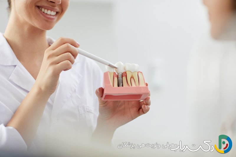 بهترین مقاصد برای انجام ایمپلنت دندان کدامند؟