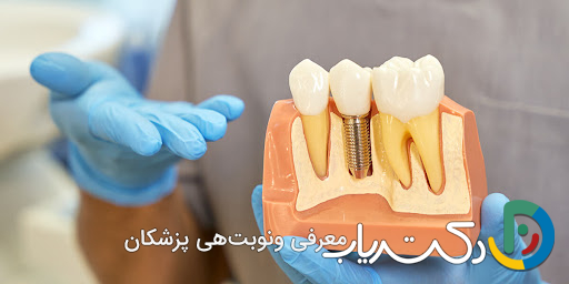 آیا ایمپلنت دندان به مراقبت خاصی نیاز دارد؟