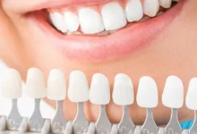 آیا باید روکش دندان را در شب از دهان خارج کنیم؟