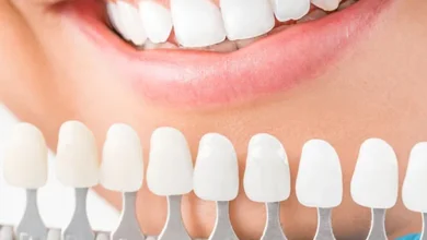 آیا باید روکش دندان را در شب از دهان خارج کنیم؟