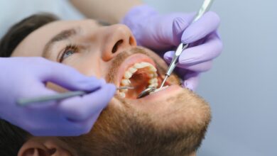 آیا برای مراقبت از ایمپلنت دندان باید به دندان پزشک مراجعه کرد؟