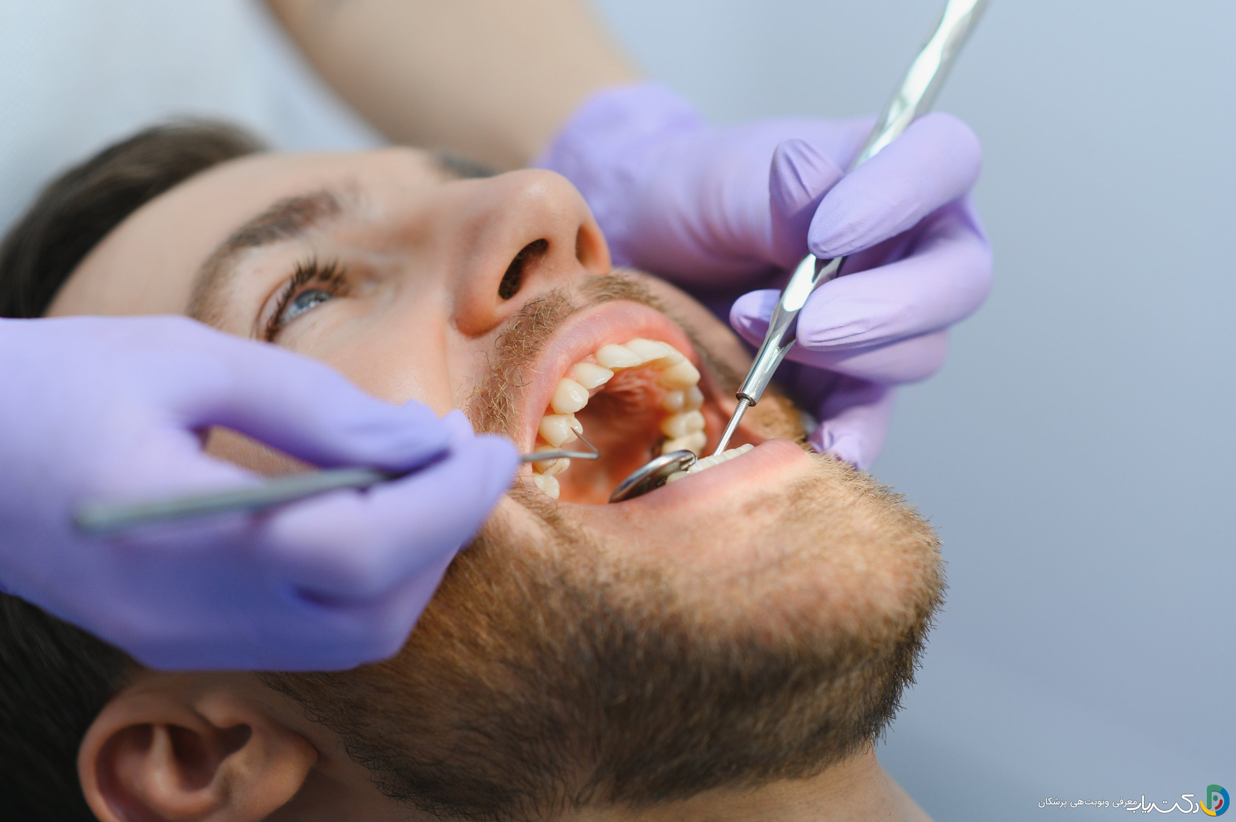 آیا برای مراقبت از ایمپلنت دندان باید به دندان پزشک مراجعه کرد؟