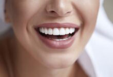 آیا برای بلیچینگ دندان نیاز به مراجعه مکرر است؟