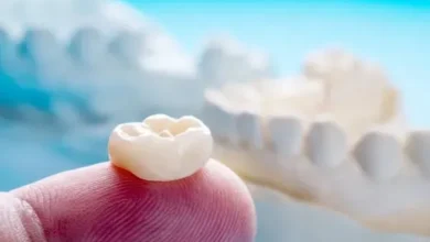 آیا روکش دندان باعث درد یا ناراحتی می شود؟