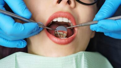 آیا ایمپلنت دندان نیاز به چکاپ دوره ای دارد؟