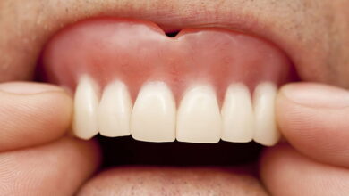آیا دندان مصنوعی باعث آسیب به لثه ها می شود؟