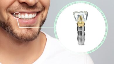 آیا ایمپلنت هم مانند دندان طبیعی دچار پوسیدگی می شود؟