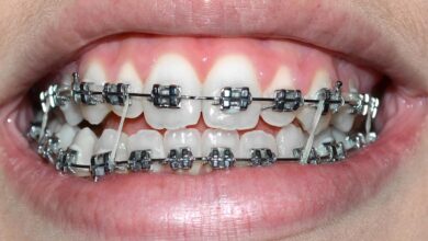 آیا ارتودنسی باعث بهبود گفتار می شود؟