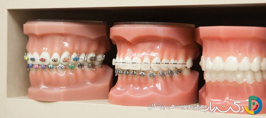 آیا هزینه ارتودنسی در کشورهای مختلف متفاوت است؟